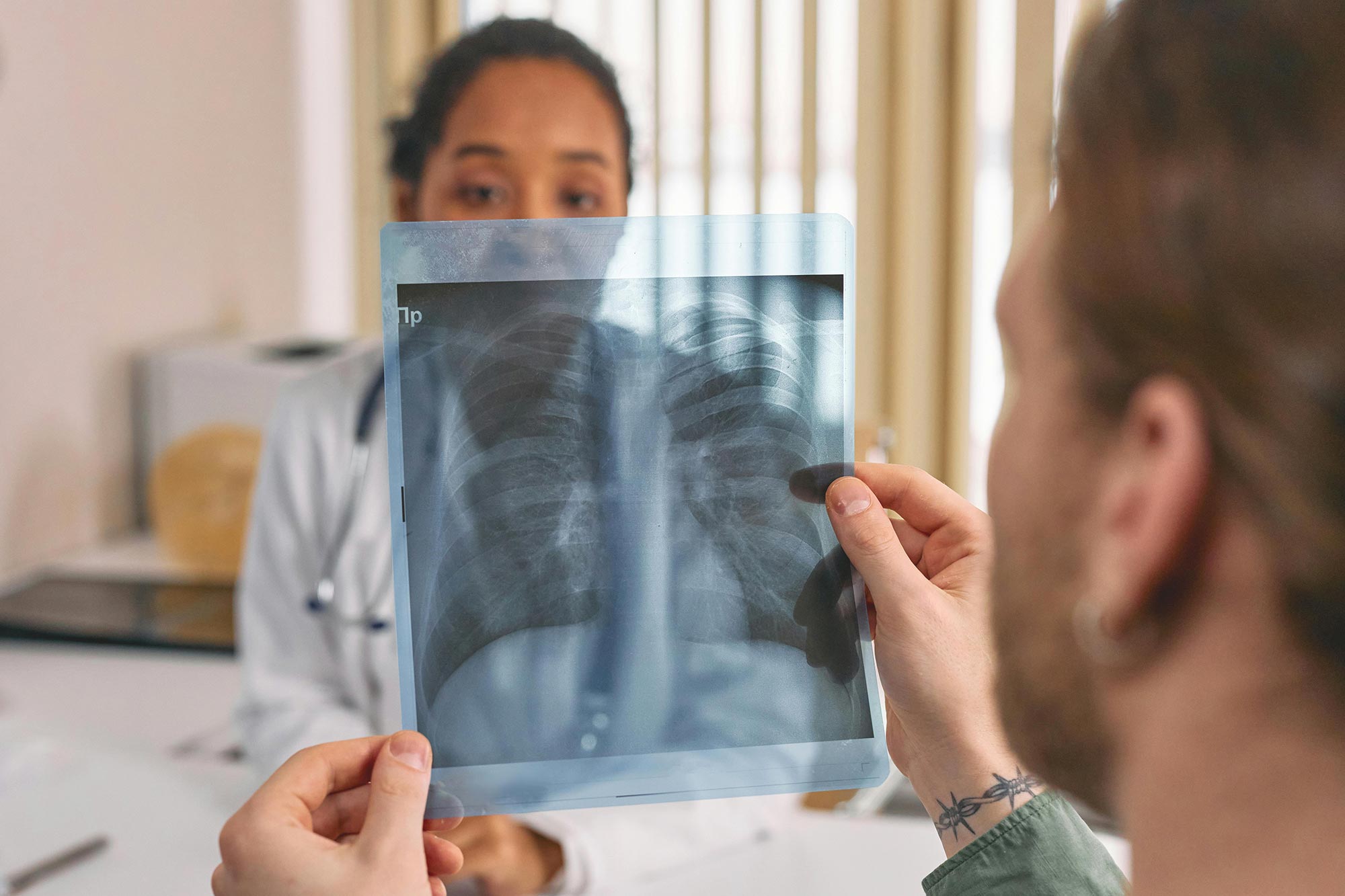 Radiografía-pulmonar-Precision-ILD